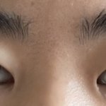 [꼭조언부탁] <b>쌍수</b>재수술하면 망하려나?