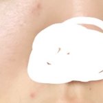 나 피부 좋아진 거 볼 사람