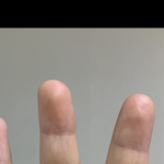 얘들아 나 손가락 휘어있는거 보여…? 병원갈까