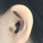<b>트라</b>거스 피딱지 어떡해??