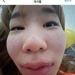 <b>조두</b>팔 왜이럼