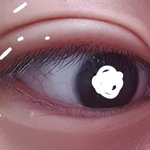 쌍수 며칠<b>차인</b>것같음 ㅠㅠㅠㅠㅠ?