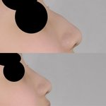 [댓글부탁해] 매<b>부리</b>코 포토샵 해봄 어때