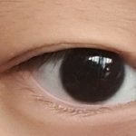 내눈 쌍수로 <b>회생</b> 가능한가..?