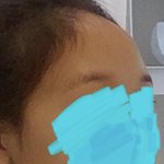 [댓글부탁해] 이거 <b>이마</b> 넓은거냐