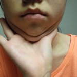 내 <b>턱살</b> 구경해바