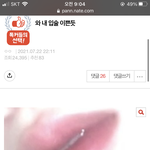[댓글부탁해] 이런입술 <b>필러</b>로가능?