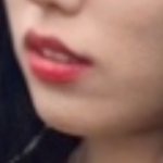 이런 <b>무턱</b>은 어떻게 고치냐