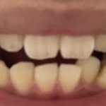 교정해본 친구들 ㅈㅂ들어와조 우주<b>상향</b> 대학 붙을거임