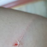 [이것좀봐줘] <b>헬스</b>장 다쳤는데 화나네요