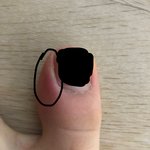 [댓글부탁해] 이거 <b>내성</b>발톱 증상이냐....??