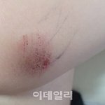 "숨이 안쉬어져" 5살 아이에 과잉<b>진압</b>? 경찰 "사실 아냐"