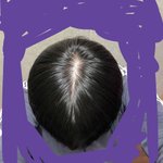 [댓글부탁해] 제발 들어와줘.. 이거 탈모 <b>조짐</b>이야❓