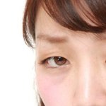 [뷰티] 쌍수를 결심한 이유가 이거임?