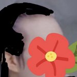 저번에 탈모글 얘 누구임