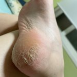 ㅋㅋ<b>내발</b>이길사람있?
