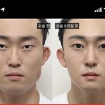 얘들아 이 성형<b>전후</b> 포토샵같냐