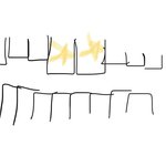 이런 토끼이빨은 교정 어떻게 해??