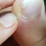 (역겨움주의)<b>발톱</b>털 나만있음??