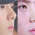 <b>세훈</b> 코수술 한거 아님?