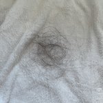 나 <b>탈모</b> 아니지