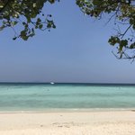 [꼭조언부탁] <b>볼살</b> 많은거 진짜 복받은거아님?