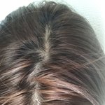 [이것좀봐줘] <b>탈모</b>시작된거야....??? 사진 좀 봐줘ㅜㅜㅜㅜㅜㅜㅜㅜㅜㅜ