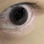 !혐! 내 눈 뭐임 왜이럼 <b>눈병</b> 그런거임?
