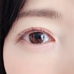 40만원 없어서 <b>쌍수</b>안하는 애들