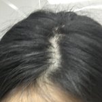 [19] 헐 얘들아 나 <b>탈모</b> ㅈ됨