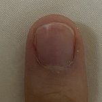 나 <b>중지</b>손톱 존귀임