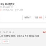 [댓글부탁해] 써지컬 스틸 언제까지 껴도 될까