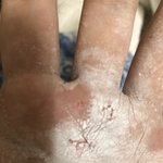 강아지 <b>치킨뼈</b> 뺏다가 손 물림