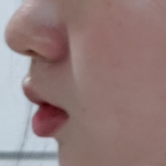 [사진ㅇ] 나 <b>무턱</b>이야?