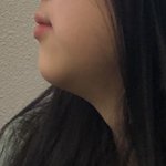 [19] 내 <b>무턱</b> 볼 사람 ㅋㅋ큐ㅠ