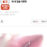 [댓글부탁해] 이런입술<b>필러</b>로 가능할까