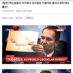 터키에서 <b>접종</b>자가 꼬리달린 애기 낳음