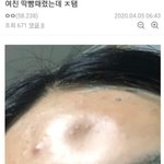 와 이거 심각한 상황 아님???