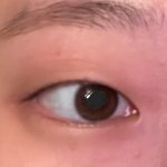 쌍수할껀데 앞트임 할까말까