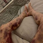 아옳이 <b>의료</b>사고 글 봄?