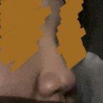 얘들아 콧볼 큰 건 <b>수술</b>밖에 답이 없으까…