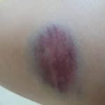 남친이랑 전화하다가 빡쳐서 <b>세면대</b> 무릎으로 들이받음