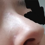 내 코 <b>복코</b>야??