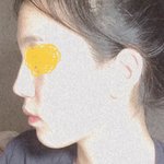 [댓글부탁해] 내 얼굴 <b>옆선</b> 문제가 뭘까?ㅜ