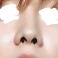 이 코 <b>필러</b>맞은것같음?