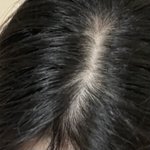 [이것좀봐줘] 나 이거 탈모 맞아?