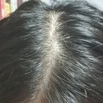 [이것좀봐줘] 나 <b>탈모</b>인지 봐줘ㅜ