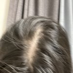 [댓글부탁해] 나 <b>탈모</b>인가?ㅠㅠ