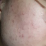 나 피부 ㅈㅁ 인데 어떡함