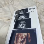 헐 조두팔 <b>추카추카</b>~~